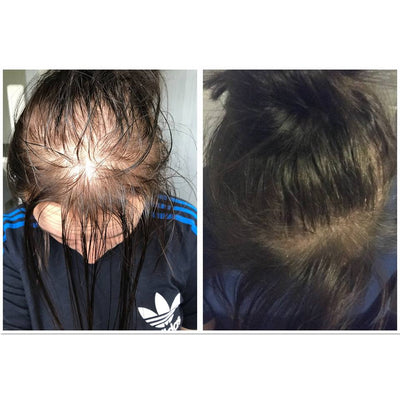 GROW MORE SCALP ELIXIR