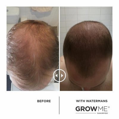 GROW MORE SCALP ELIXIR